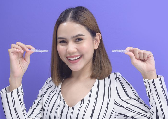 How Invisalign Works - A Step-by-Step Guide to Clear Aligner Treatment
